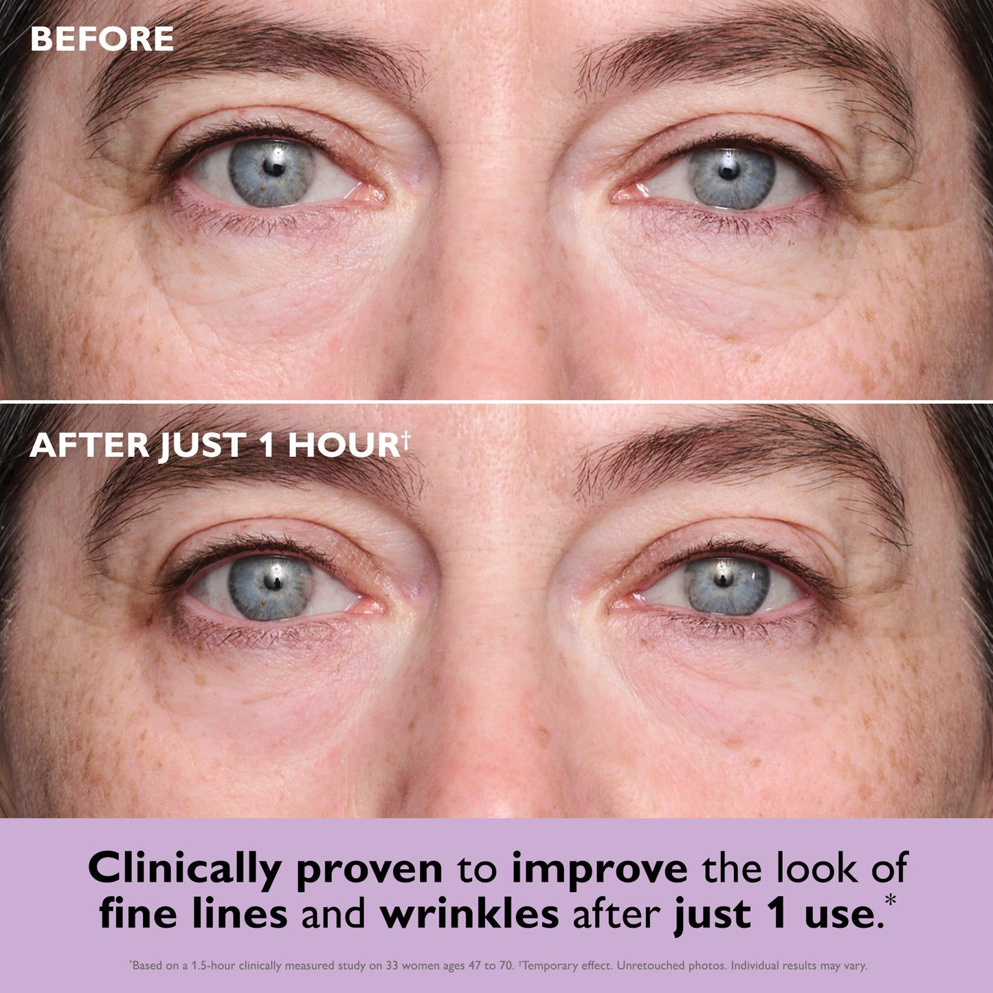 Tightening Eye Patches Collagen Infusion